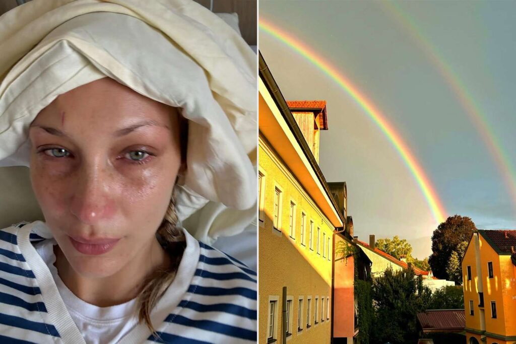 Bella Hadid Shares Photos from Hospital Bed on Instagram: ‘I Love You Guys’