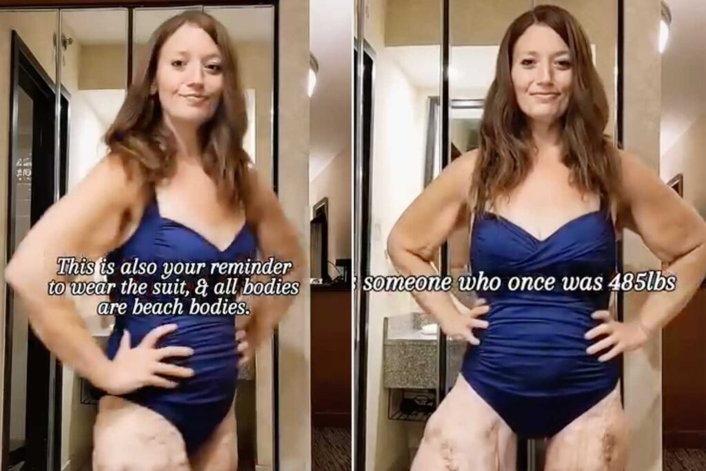 Influencer Lexi Reed Posts Powerful Video Wearing Swimsuit After 300-Lb. Weight Loss