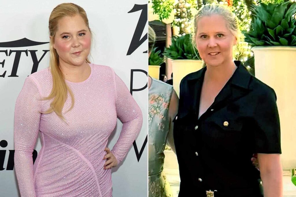 Amy Schumer Shows Off Major Weight Loss: Photo