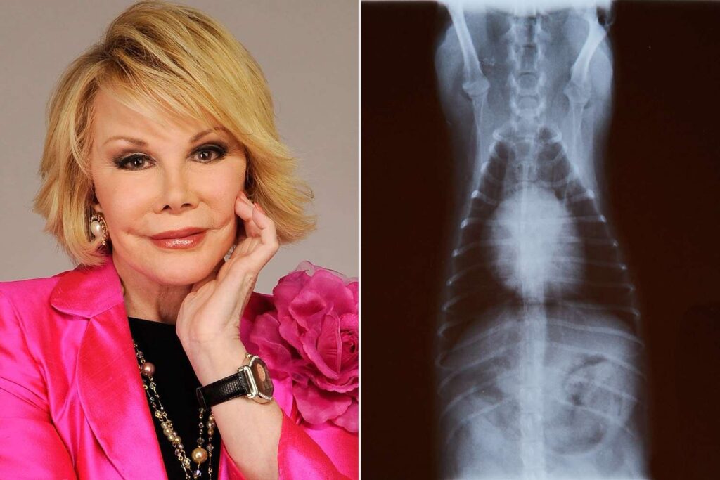 Joan Rivers’ Shag Wigs, Dog’s X-Rays and Royal Family Keepsakes Auctioned Off