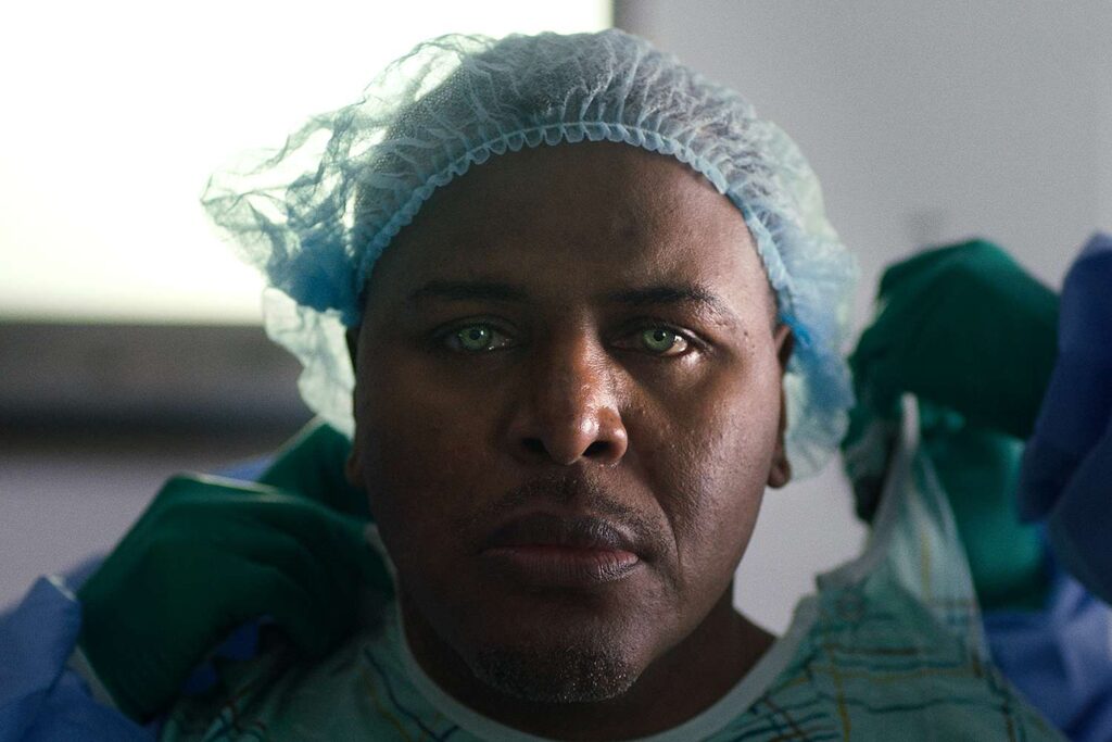 A Biracial Man Faces ‘Scary’ Toll After Changing Eye Color Through Risky Surgery