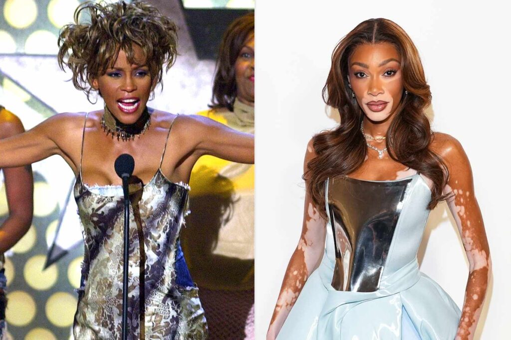 Winnie Harlow Responds to Blowback for Whitney Houston Halloween Costume